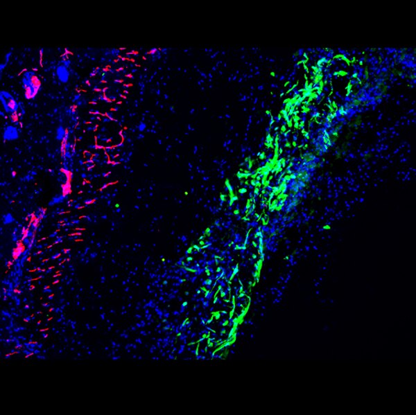 Immunofluorescent image of mouse SCs transplanted into Matrigel plugs labeled with DSHB antibody P2B1 against PECAM1/CD31 (red). PMID: 30745033, Fig. S2.